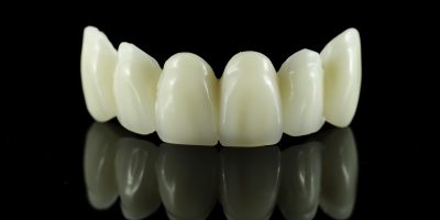 Dental tooth bridge